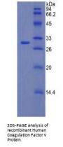 Human Coagulation Factor V (F5) Protein