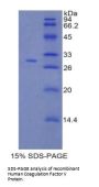 Human Coagulation Factor V (F5) Protein