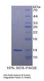 Human Coagulation Factor VII (F7) Protein