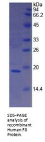 Human Coagulation Factor VIII (F8) Protein