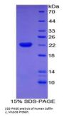 Human Cofilin 2, Muscle (CFL2) Protein