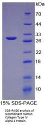 Human Collagen Type IV Alpha 2 (COL4A2) Protein