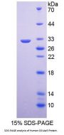 Human Collagen Type IV Alpha 5 (COL4A5) Protein