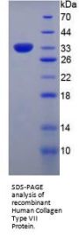 Human Collagen Type VII Alpha 1 (COL7A1) Protein