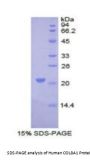 Human Collagen Type VIII Alpha 1 (COL8A1) Protein