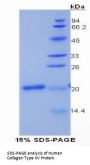 Human Collagen Type XV Alpha 1 (COL15A1) Protein
