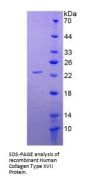 Human Collagen Type XVII Alpha 1 (COL17A1) Protein