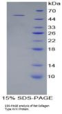 Rat Collagen Type XVIII Alpha 1 (COL18A1) Protein