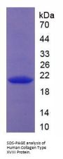 Human Collagen Type XVIII Alpha 1 (COL18A1) Protein