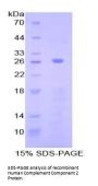 Human Complement C2 (C2) Protein