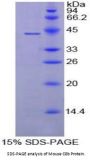Mouse Complement Component 8b (C8b) Protein