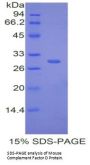 Mouse Complement Factor D (CFD) Protein