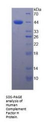 Human Complement Factor H (CFH) Protein