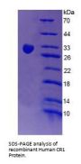 Human Complement Receptor Type 1 / CD35 (CR1) Protein