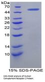 Human Complement Receptor 2 / CD21 (CR2) Protein