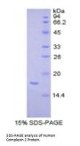 Human Complexin 2 (CPLX2) Protein