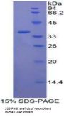 Human C-Raf Proto Oncogene Serine/Threonine Protein Kinase (CRAF) Protein