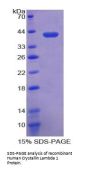 Human Crystallin Lambda 1 (CRYL1) Protein