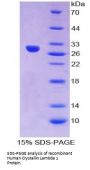 Human Crystallin Lambda 1 (CRYL1) Protein
