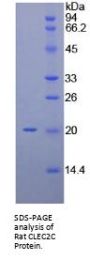Rat Early Activation Antigen CD69 (CD69) Protein