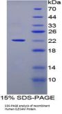 Human C-Type Lectin Domain Family 4, Member M (CLEC4M) Protein