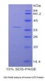 Human CutC Copper Transporter (CUTC) Protein