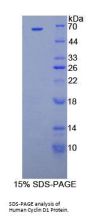 Human Cyclin D1 (CCND1) Protein