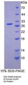 Human G1/S-Specific Cyclin-D2 (CCND2) Protein