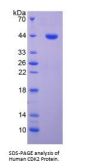 Human Cyclin Dependent Kinase 2 (CDK2) Protein