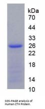 Human Cystathionine Gamma-Lyase (CTH) Protein