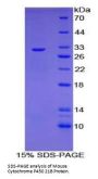 Mouse Steroid 21-Hydroxylase (CYP21A2) Protein