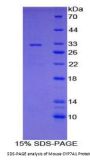 Mouse Cytochrome P450 7A1 (CYP7A1) Protein