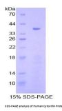 Human Cytovillin (CVL) Protein