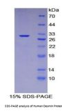Human Desmin (Des) Protein