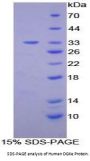 Human Diacylglycerol Kinase Epsilon (DGKe) Protein