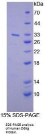 Human Diacylglycerol Kinase Gamma (DGKg) Protein