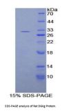 Rat Diacylglycerol Kinase Gamma (DGKg) Protein