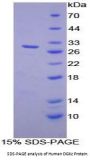 Human Diacylglycerol Kinase Zeta (DGKz) Protein