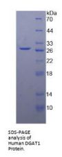 Human Diacylglycerol-O-Acyltransferase Homolog 1 (DGAT1) Protein