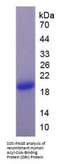 Human Acyl-CoA-Binding Protein / ACBP-1b (DBI) Protein