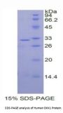 Human Dickkopf-Related Protein 1 (DKK1) Protein