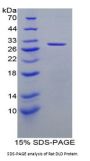 Rat Dihydrolipoyl Dehydrogenase (DLD) Protein