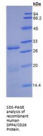 Human Dipeptidyl Peptidase 4 / CD26 (DPP4) Protein