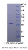 Human Dishevelled, Dsh Homolog 1 (DVL1) Protein
