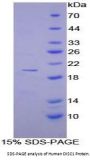 Human Disrupted In Schizophrenia 1 (DISC1) Protein