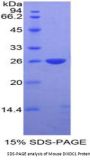 Mouse DIX Domain Containing Protein 1 (DIXDC1) Protein