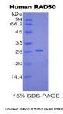 Human DNA Repair Protein RAD50 (RAD50) Protein