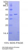 Human Dystrophin (DMD) Protein