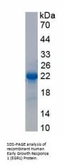 Human Early Growth Response 1 (EGR1) Protein