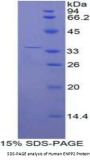 Human Ectonucleotide Pyrophosphatase/Phosphodiesterase 2 (ENPP2) Protein